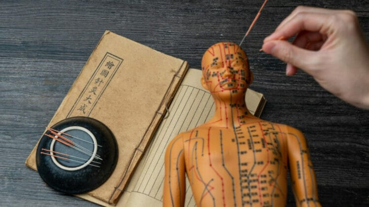 O calatorie prin istoria acupuncturii